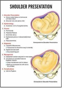 Shoulder Presentation Chart