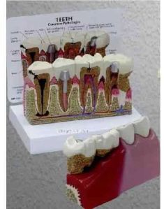 Teeth Model With Plate