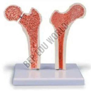 Bone Joint Models