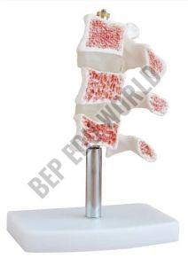 PVC Osteoporosis Bone Joint Model For Medical Institute, Nursing Institute