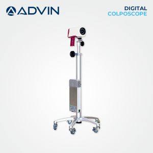 Polished Digital Video Colposcope For Clinic, Hospital