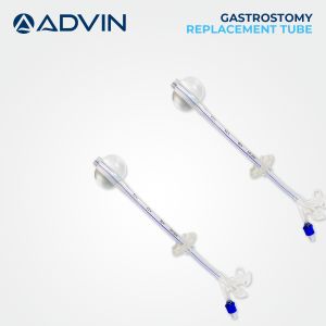 Gastrostomy Replacement Tube