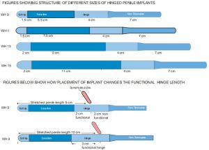 Shah Penile Implant, Color : SIlver