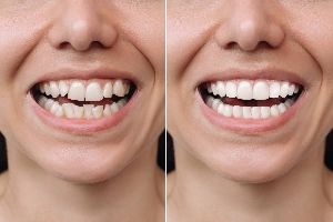 Cosmetic Dentistry