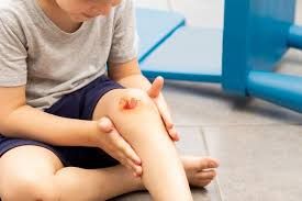 Pediatric Wounds Online Consultation