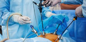 Laparoscopic Treatment