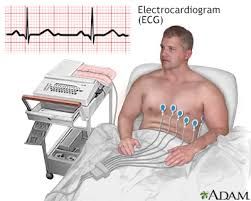 Multi Channel ECG Services