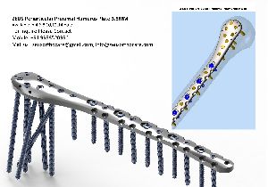 ZEUS Periarticular Proxima Humerus Plate