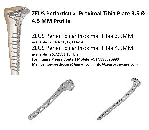 ZEUS Periarticular Proximal Tibia Plate