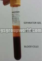 Serum Separating Tubes