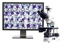 Automated blood cell image analysis system