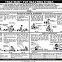 Shock Treatment Chart