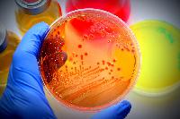 microbial culture