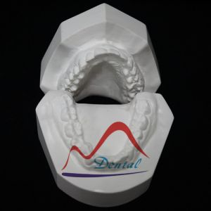 Hand-sculpted Dental Orthodontic Model