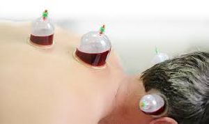 Wet Cupping Therapy
