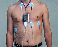 Holter Monitor