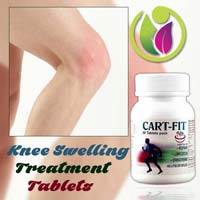 Knee Swelling Treatment Tablets