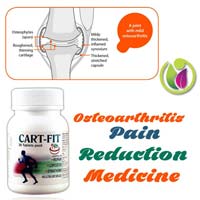 Osteoarthritis Pain Reduction Medicine