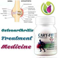 Osteoarthritis Treatment Medicine