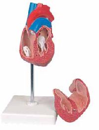 Heart Hypertrophy Model