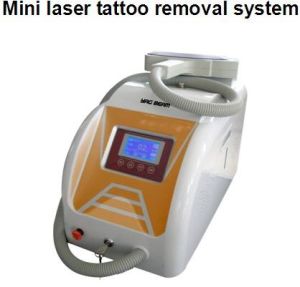 Nd: Yag Laser For Tattoo Removal Beauty Equipment