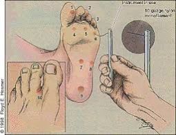 Monofilaments Diabetes