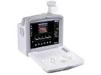 doppler ultrasound scanner