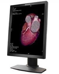 20.1'' 2mp Color Medical Display