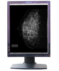 21.3'' 5mp Grayscale Medical Display