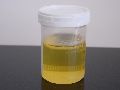 Yellow Liquid donkey urine
