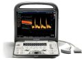 Sonoscape S6 Colour Doppler Ultrasound