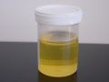 Yellow Liquid donkey urine