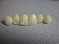 Dental Ceramic Crowns