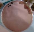 Deoxycholate Citrate Agar Plate